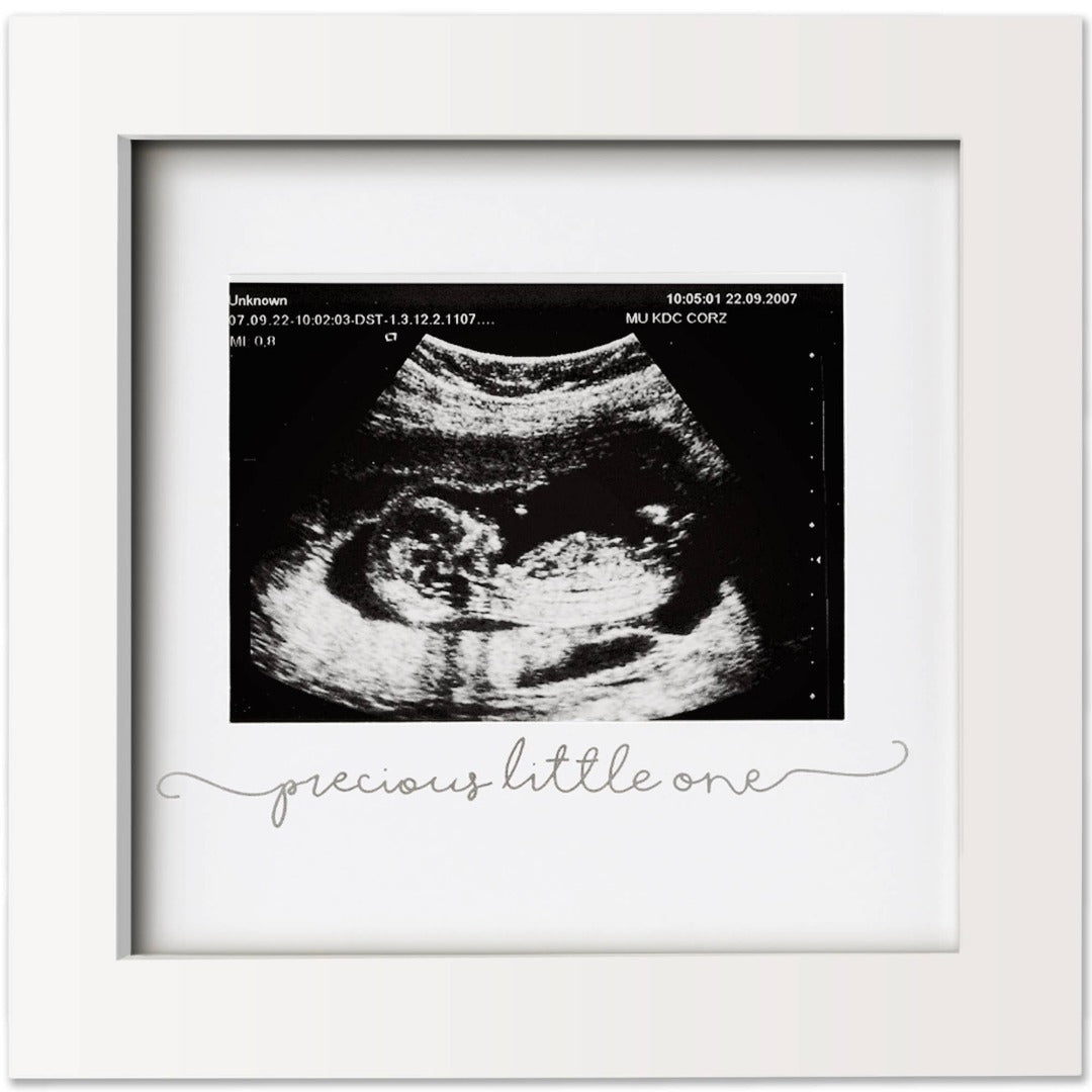 White picture frame with a sonogram inside